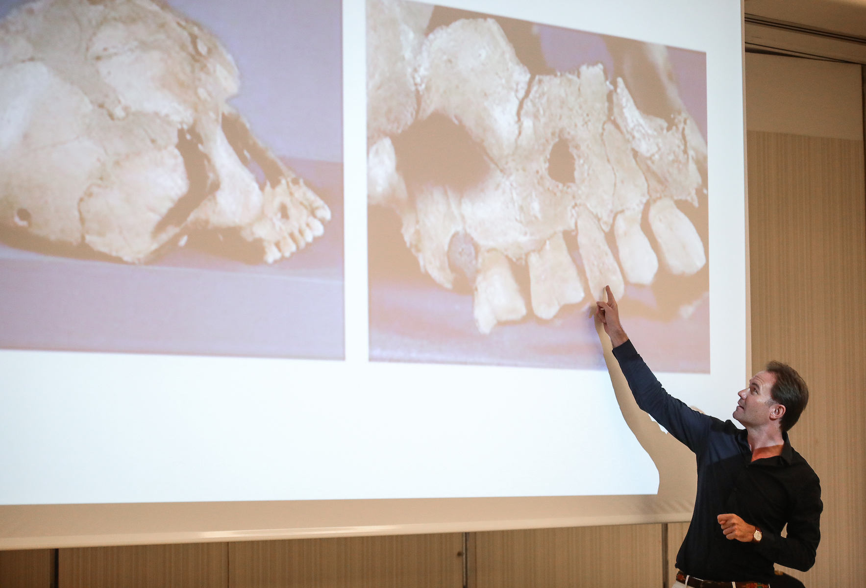 Vitaldent - Sesiones AFE XXVIII